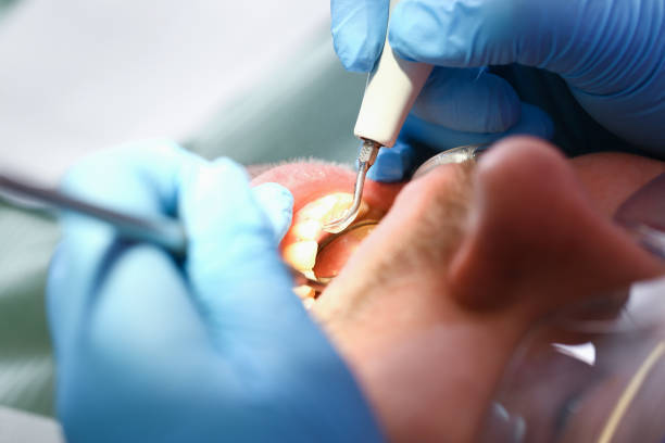 Best Emergency Dentist for Knocked-Out Tooth in Williams, CA