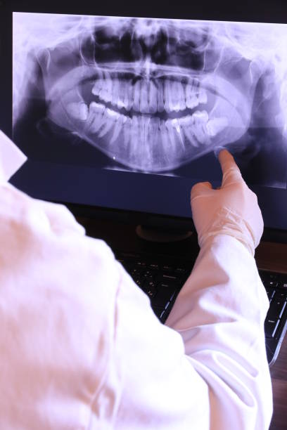 Best Emergency Dental Services for Seniors in Williams, CA