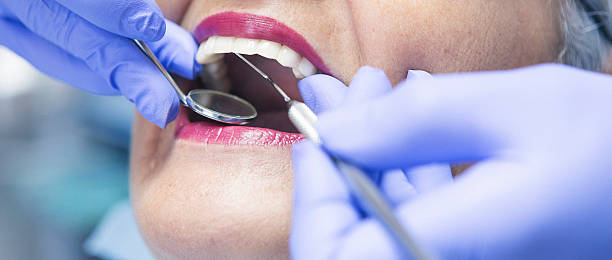 Best Emergency Root Canal Treatment in Williams, CA